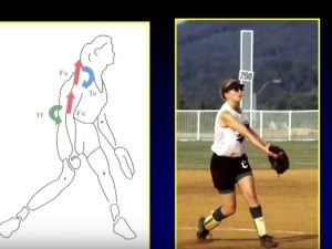 Wilk PTI Online: Rehabilitation of the Female’s Throwing Shoulder