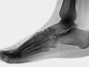 Wilk PTI Online:  Anatomy of the Foot and Ankle Complex