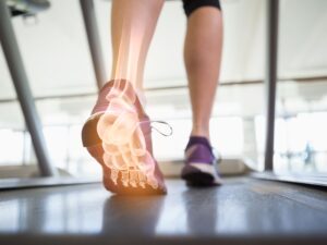 Stop the Guessing Game: Implementing a Criterion and Evidence Based Functional Performance Testing Algorithm Function in Foot and Ankle Injuries