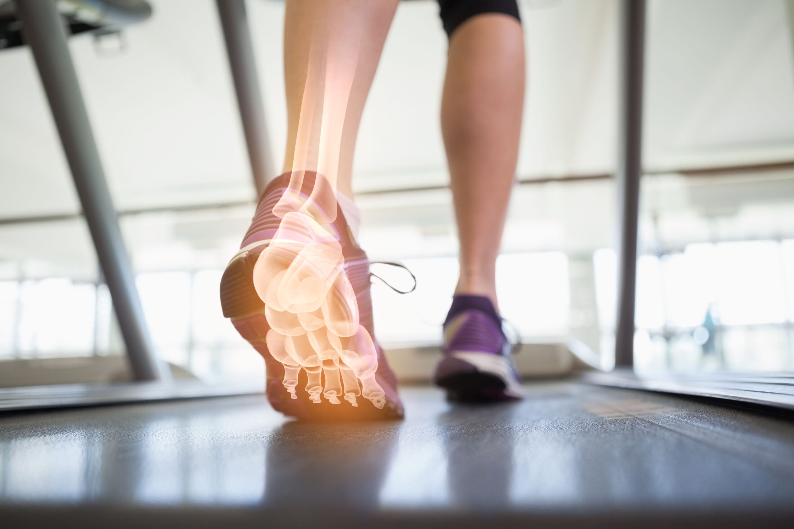 Stop the Guessing Game: Implementing a Criterion and Evidence Based Functional Performance Testing Algorithm Function in Foot and Ankle Injuries